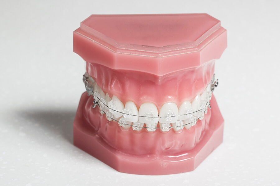 歯の位置を調整する後半期